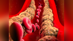 Things people ignore about cholesterol