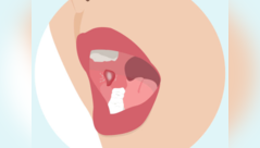 Areas in your mouth where cancer can begin