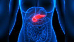 Two early symptoms of Pancreatic cancer