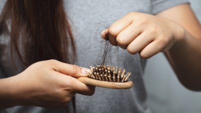What Are the Causes for Temple Hair Loss & Its Treatments